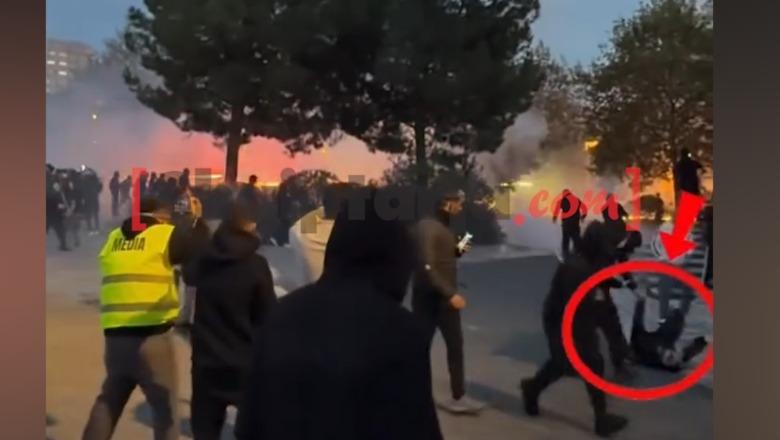 Erjon Vishkulli lëndohet në sy nga fishekzjarrët gjatë festimeve